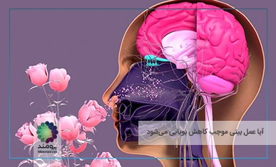 تصویر شاخص آیا عمل بینی موجب کاهش بویایی می‌شود