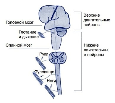 Разница между БАС и БДН 3 Виды Болезней Двигательного Нейрона