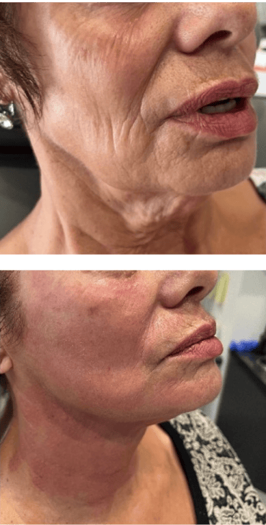 signs of aging