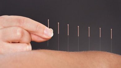 علاج الام الظهر بالوخز بالأبر