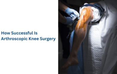 Arthroscopic Knee Surgery