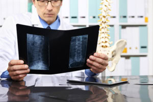 Spine surgeon examining x-rays