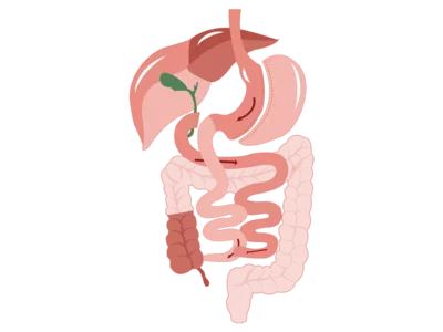 Duodenal Switch