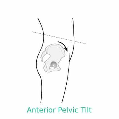 Anterior Pelvic Tilt