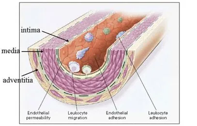 Low-Density Lipoprotein (LDL) in Atherosclerosis and Heart Disease