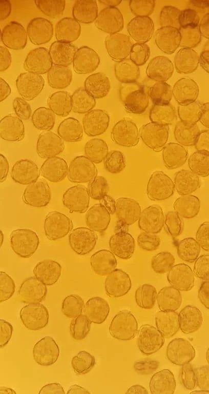 A picture of pepper pollen under the microscope