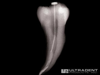 2_NaviTip-Clinical_Radiograph