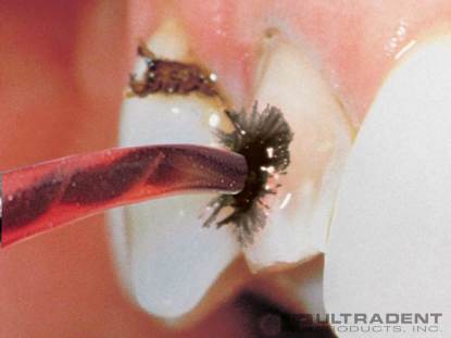 4_Inspiral-Brush-Clinical