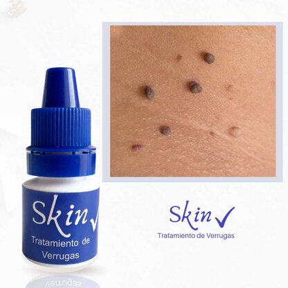 Tratamiento Eliminador de Verrugas SKIN