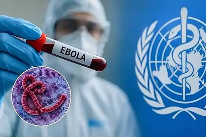 Ebola : 10 choses à savoir sur l’épidémie qui inquiète l’OMS