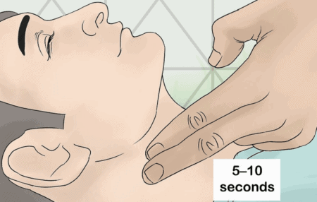 Carotid Sinus Massage