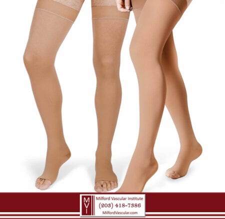 Varicose Vein Surgery Recovery New Haven CT Varicose Vein Surgery Recovery New Haven CT