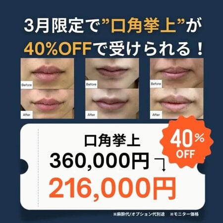 キャンペーン