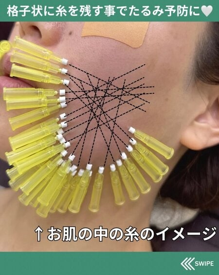 糸のイメージ