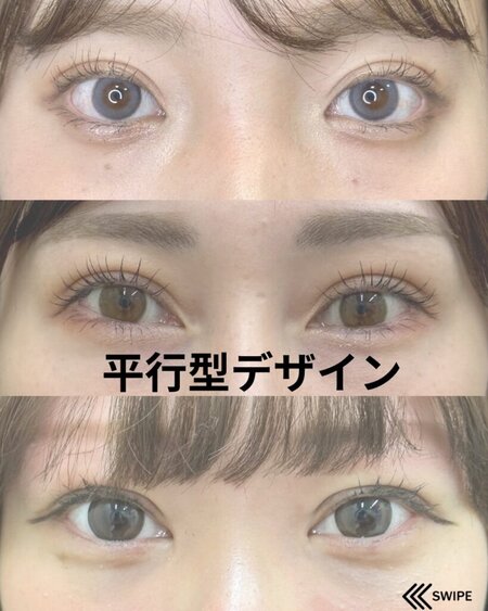 平行型デザイン