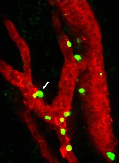 Lymphocyte killer tumor