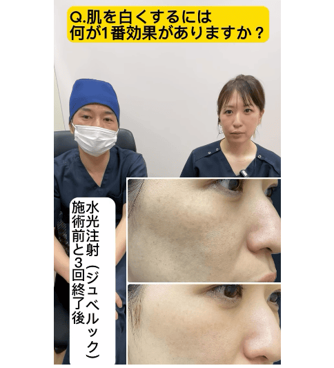 肌を白くする