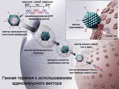 Генная терапия Генная терапия