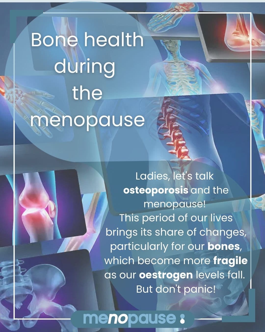 Bone health during the menopause
