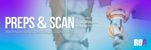 Preps & Scan : Un Enfoque Digital de las Restauraciones ParcialesAdhesiva.