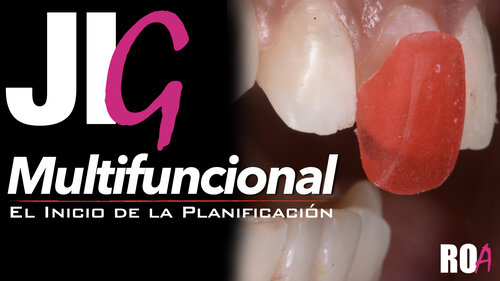 JIG MULTIFUNCIONAL : El inicio de la Planificación .
