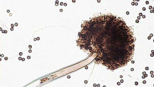 Разница между Аспергиллезом и Афлатоксикозом 2 Споры Аспергилл (Aspergillus) под микроскопом