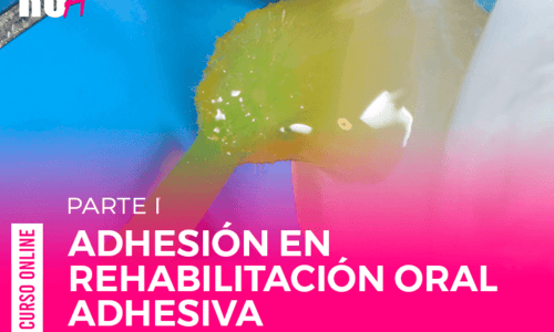 Adhesión en Rehabilitación Oral Adhesiva Parte 1.