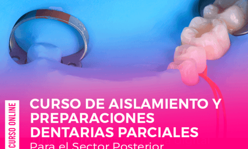 Curso de Aislamiento y Preparaciones Dentarias Parciales para el Sector Posterior .