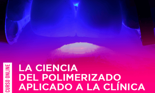 La Ciencia del Polimerizado Aplicado a la Clínica.