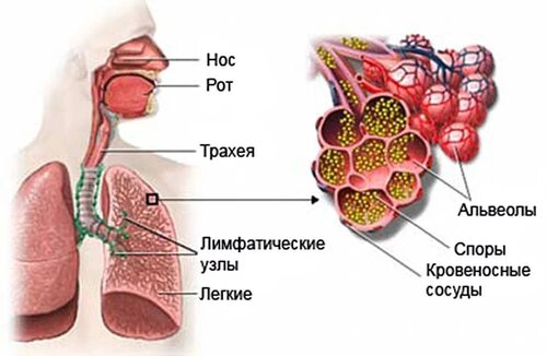 Разница между Аспергиллезом и Афлатоксикозом 3 Аспергиллез