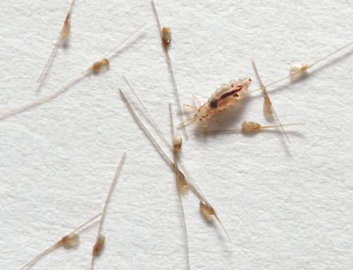 What Do Head Lice Look Like?