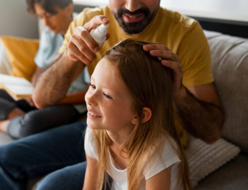 What Parents Should Know About Lice During Summer