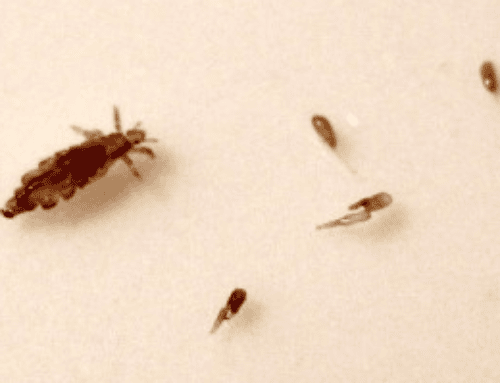 How to Tell If Nits Are Alive or Dead