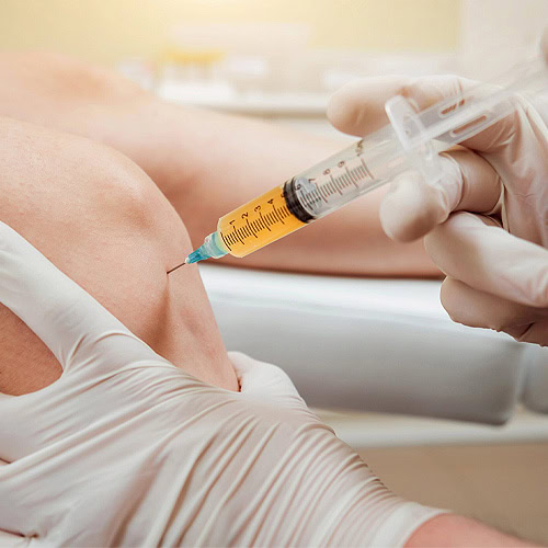 PRP Therapy