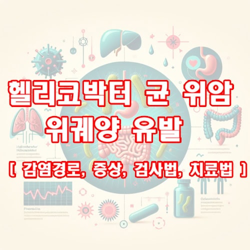 헬리코박터 균 위암, 위궤양 유발 [ 감염경로, 증상, 검사법, 치료법 ]