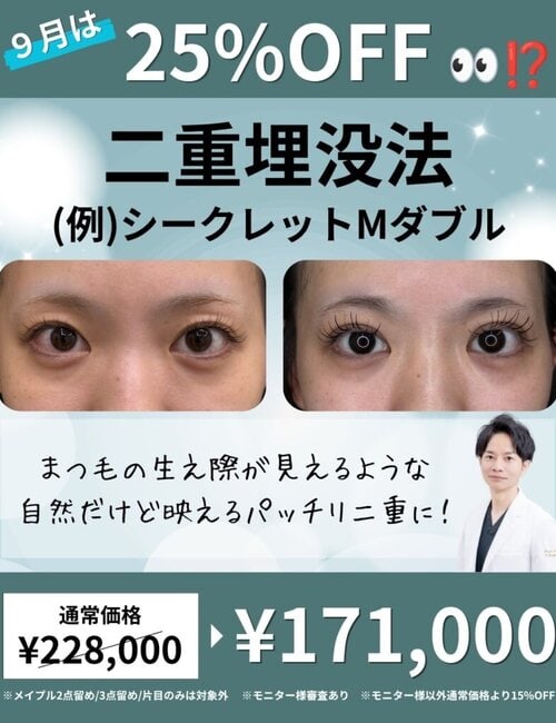 二重埋没法キャンペーン