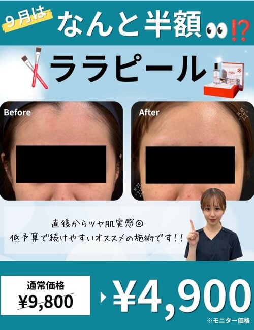 ララピール