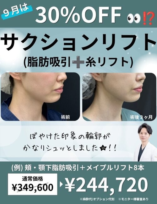 サクションリフト