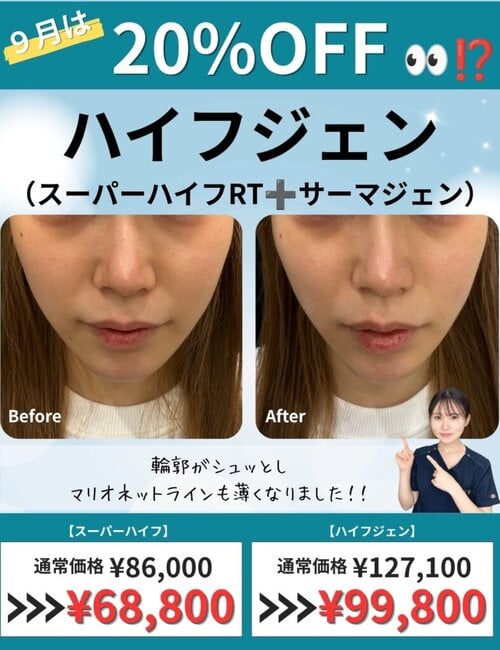 ハイフジェン