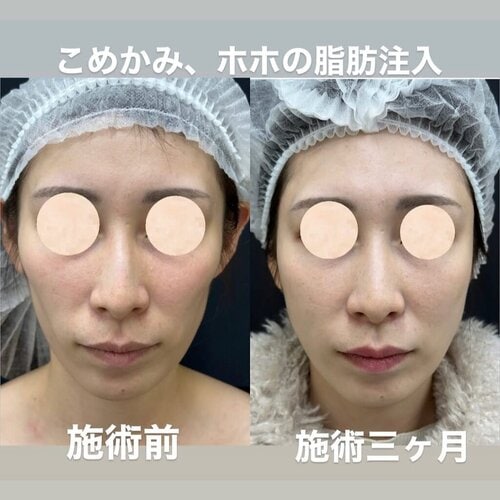 若返り