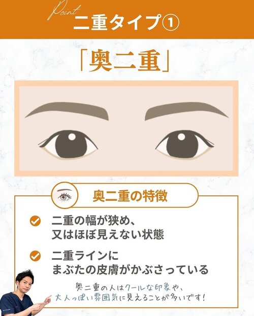 奥二重
