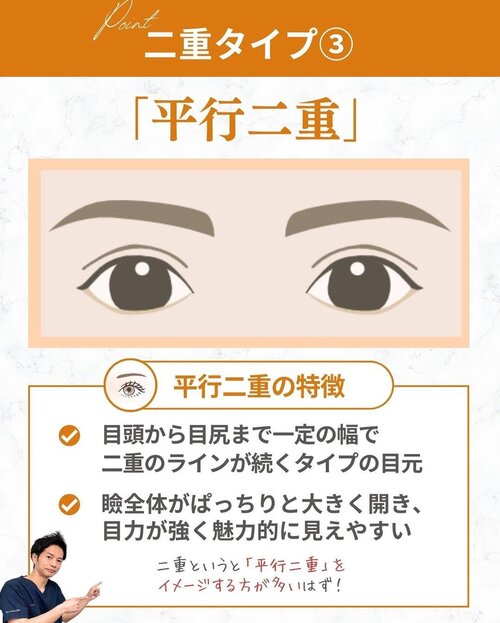 平行二重