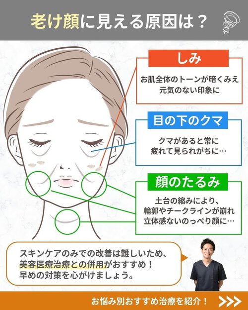 老け顔
