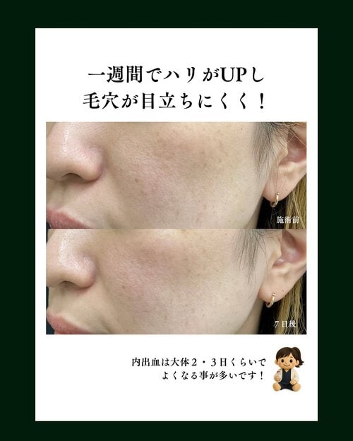 効果