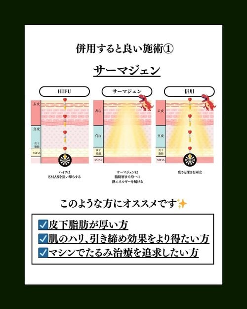 サーマジェン
