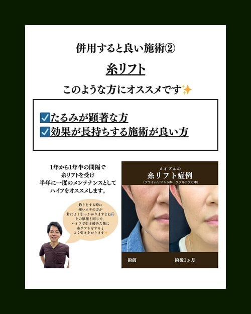 糸リフト併用