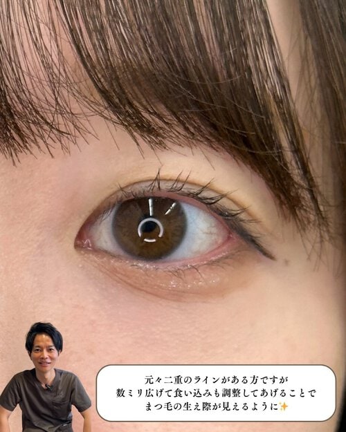 施術後