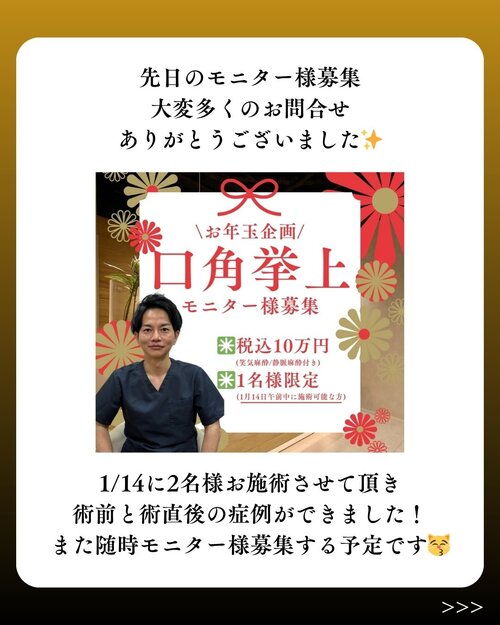 口角拳上モニター