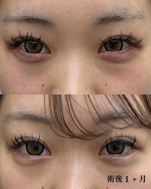 症例