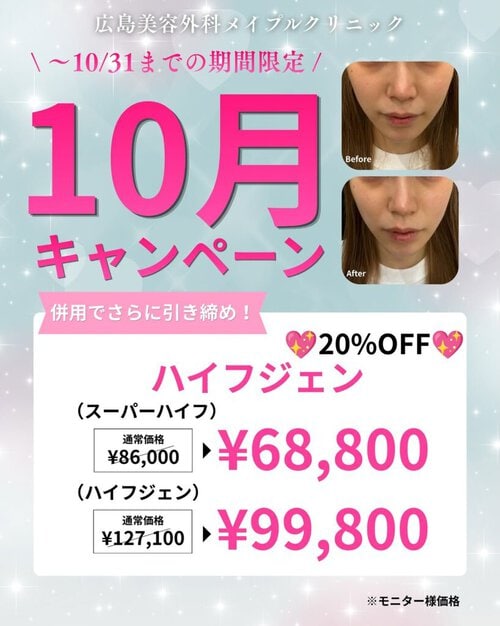 ハイフ